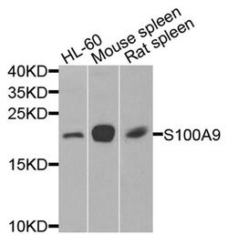 Invitrogen S100A9 Polyclonal Antibody 100 &mu;L; Unconjugated:Antibodies,