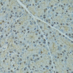 Invitrogen SERPINF2 Polyclonal Antibody 100 &mu;L; Unconjugated:Antibodies,