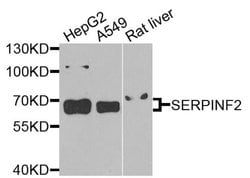 Invitrogen SERPINF2 Polyclonal Antibody 100 &mu;L; Unconjugated:Antibodies,