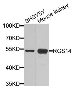 Invitrogen RGS14 Polyclonal Antibody 100 &mu;L; Unconjugated:Antibodies,