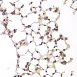 Invitrogen VRK1 Polyclonal Antibody 100 &mu;L; Unconjugated:Antibodies,