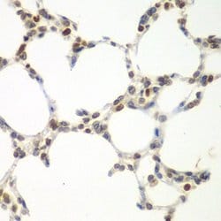 Invitrogen VRK1 Polyclonal Antibody 100 &mu;L; Unconjugated:Antibodies,