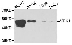 Invitrogen VRK1 Polyclonal Antibody 100 &mu;L; Unconjugated:Antibodies,