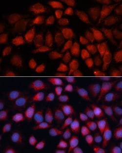 Invitrogen ACADM Polyclonal Antibody 100 &mu;L; Unconjugated:Antibodies,