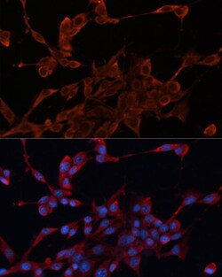 Invitrogen HDJ2 Polyclonal Antibody 100 &mu;L; Unconjugated:Antibodies,