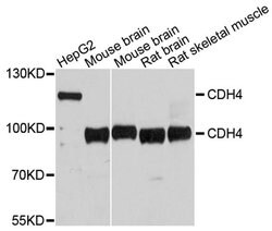 Invitrogen CDH4 Polyclonal Antibody 100 &mu;L; Unconjugated:Antibodies,