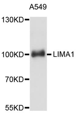 Invitrogen EPLIN Polyclonal Antibody 100 &mu;L; Unconjugated:Antibodies,