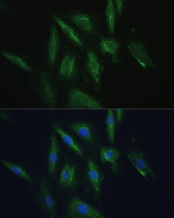 Invitrogen SRPRB Polyclonal Antibody 100 &mu;L; Unconjugated:Antibodies,