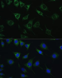 Invitrogen SRPRB Polyclonal Antibody 100 &mu;L; Unconjugated:Antibodies,