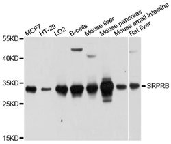 Invitrogen SRPRB Polyclonal Antibody 100 &mu;L; Unconjugated:Antibodies,