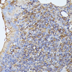 Invitrogen MST3 Polyclonal Antibody 100 &mu;L; Unconjugated:Antibodies,