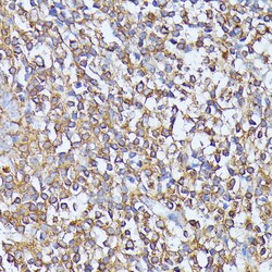 Invitrogen MST3 Polyclonal Antibody 100 &mu;L; Unconjugated:Antibodies,