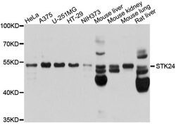 Invitrogen MST3 Polyclonal Antibody 100 &mu;L; Unconjugated:Antibodies,