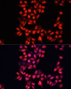Invitrogen ADAM10 Polyclonal Antibody 100 &mu;L; Unconjugated:Antibodies,