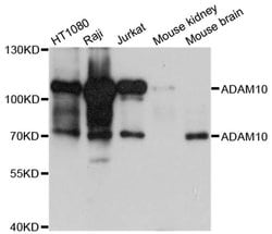 Invitrogen ADAM10 Polyclonal Antibody 100 &mu;L; Unconjugated:Antibodies,