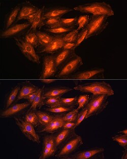 Invitrogen PHGDH Polyclonal Antibody 100 &mu;L; Unconjugated:Antibodies,