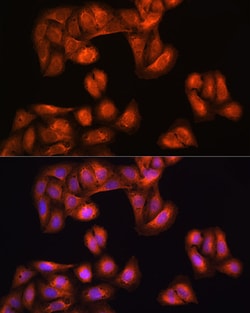 Invitrogen PHGDH Polyclonal Antibody 100 &mu;L; Unconjugated:Antibodies,