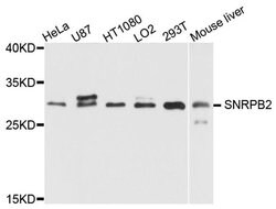 Invitrogen SNRPB2 Polyclonal Antibody 100 &mu;L; Unconjugated:Antibodies,