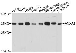 Invitrogen Annexin A3 Polyclonal Antibody 100 &mu;L; Unconjugated:Antibodies,