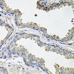 Invitrogen Aconitase 1 Polyclonal Antibody 100 &mu;L; Unconjugated:Antibodies,