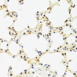 Invitrogen SUZ12 Polyclonal Antibody 100 &mu;L; Unconjugated:Antibodies,