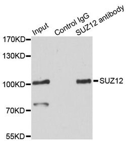 Invitrogen SUZ12 Polyclonal Antibody 100 &mu;L; Unconjugated:Antibodies,