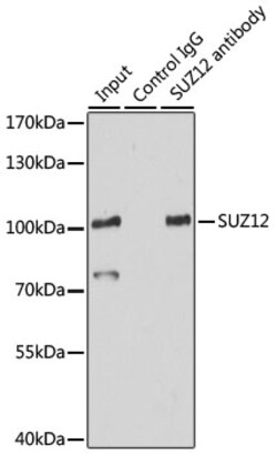 Invitrogen SUZ12 Polyclonal Antibody 100 &mu;L; Unconjugated:Antibodies,