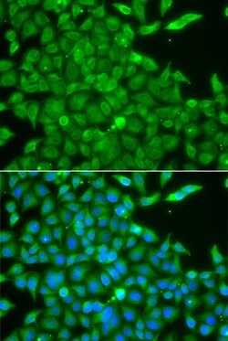 Invitrogen CK1 gamma-2 Polyclonal Antibody 100 &mu;L; Unconjugated:Antibodies,