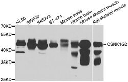 Invitrogen CK1 gamma-2 Polyclonal Antibody 100 &mu;L; Unconjugated:Antibodies,