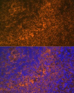 Invitrogen DR4 Polyclonal Antibody 100 &mu;L | Buy Online | Invitrogen&trade; | Fisher Scientific