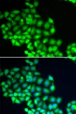 Invitrogen XPD Polyclonal Antibody 100 &mu;L; Unconjugated:Antibodies,
