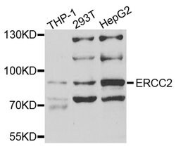 Invitrogen XPD Polyclonal Antibody 100 &mu;L; Unconjugated:Antibodies,