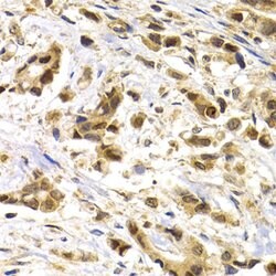 Invitrogen MAGE1 Polyclonal Antibody 100 &mu;L; Unconjugated:Antibodies,