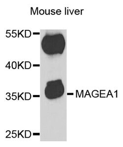 Invitrogen MAGE1 Polyclonal Antibody 100 &mu;L; Unconjugated:Antibodies,