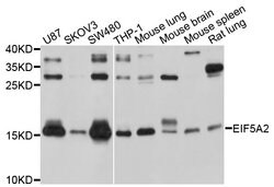 Invitrogen eIF5A2 Polyclonal Antibody 100 &mu;L; Unconjugated:Antibodies,