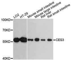 Invitrogen CES3 Polyclonal Antibody 100 &mu;L; Unconjugated:Antibodies,