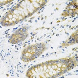 Invitrogen CD254 (RANK Ligand) Polyclonal Antibody 100 &mu;L | Buy Online | Invitrogen&trade; | Fisher Scientific