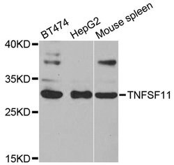 Invitrogen CD254 (RANK Ligand) Polyclonal Antibody 100 &mu;L | Buy Online | Invitrogen&trade; | Fisher Scientific