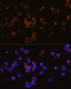 Invitrogen&trade;&nbsp;CD254 (RANK Ligand) Polyclonal Antibody