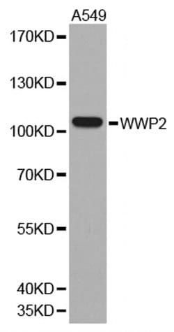Invitrogen AIP2 Polyclonal Antibody 100 &mu;L; Unconjugated:Antibodies,