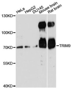 Invitrogen TRIM9 Polyclonal Antibody 100 &mu;L | Buy Online | Invitrogen&trade; | Fisher Scientific