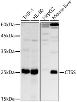 Invitrogen Cathepsin S Polyclonal Antibody 100 &mu;L | Buy Online | Invitrogen&trade; | Fisher Scientific
