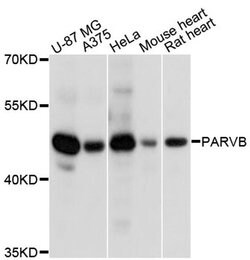 Invitrogen PARVB Polyclonal Antibody 100 &mu;L; Unconjugated:Antibodies,