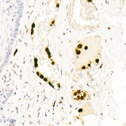 Invitrogen Neutrophil elastase Polyclonal Antibody 100 &mu;L; Unconjugated:Antibodies,