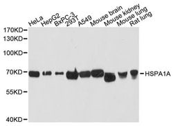 Invitrogen HSPA1A Polyclonal Antibody 100 &mu;L | Buy Online | Invitrogen&trade; | Fisher Scientific