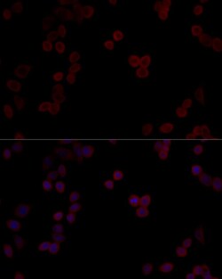 Invitrogen PP5 Polyclonal Antibody 100 &mu;L; Unconjugated:Antibodies,