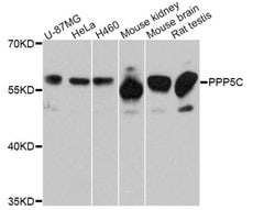 Invitrogen PP5 Polyclonal Antibody 100 &mu;L; Unconjugated:Antibodies,