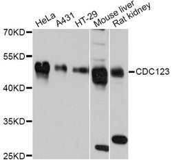 Invitrogen CDC123 Polyclonal Antibody 100 &mu;L; Unconjugated:Antibodies,