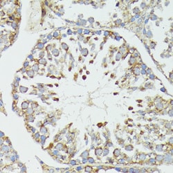 HSPA1A Polyclonal Antibody:Antibodies, Polyclonal