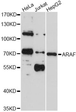 Invitrogen A-Raf Polyclonal Antibody 100 &mu;L; Unconjugated:Antibodies,